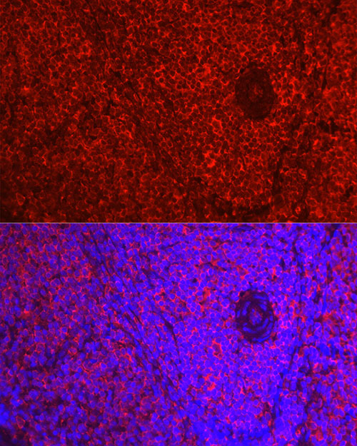 Immunofluorescence analysis of Rat spleen using ADRB1 Polyclonal Antibody at dilution of 1:50 (40x lens). Blue: DAPI for nuclear staining.