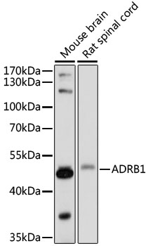 Western blot analysis of extracts of various cell lines using ADRB1 Polyclonal Antibody at 1:1000 dilution.