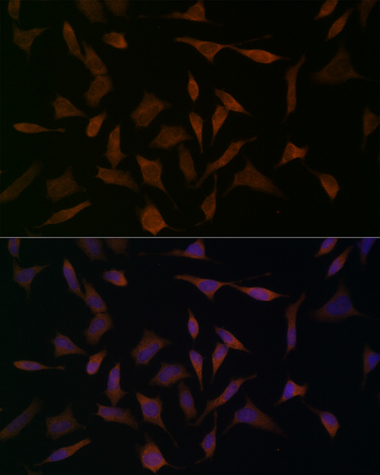 Immunofluorescence analysis of HeLa cells using BCAT1 Polyclonal Antibody at dilution of 1:100 (40x lens). Blue: DAPI for nuclear staining.