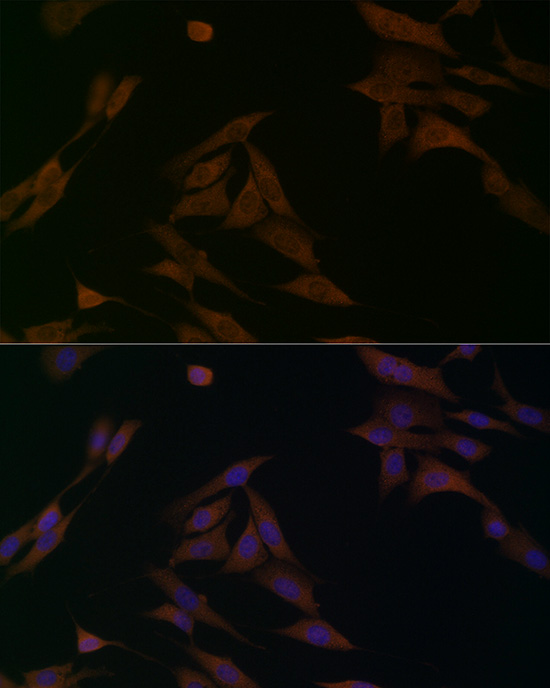 Immunofluorescence analysis of NIH/3T3 cells using BCAT1 Polyclonal Antibody at dilution of 1:100 (40x lens). Blue: DAPI for nuclear staining.