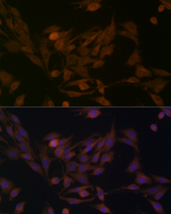 Immunofluorescence analysis of PC-12 cells using BCAT1 Polyclonal Antibody at dilution of 1:100 (40x lens). Blue: DAPI for nuclear staining.