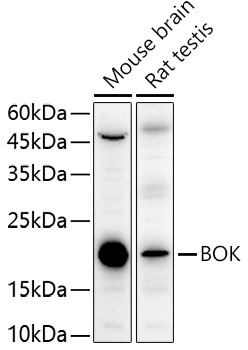 Western blot analysis of extracts of various cell lines using BOK Polyclonal Antibody at 1:1000 dilution.