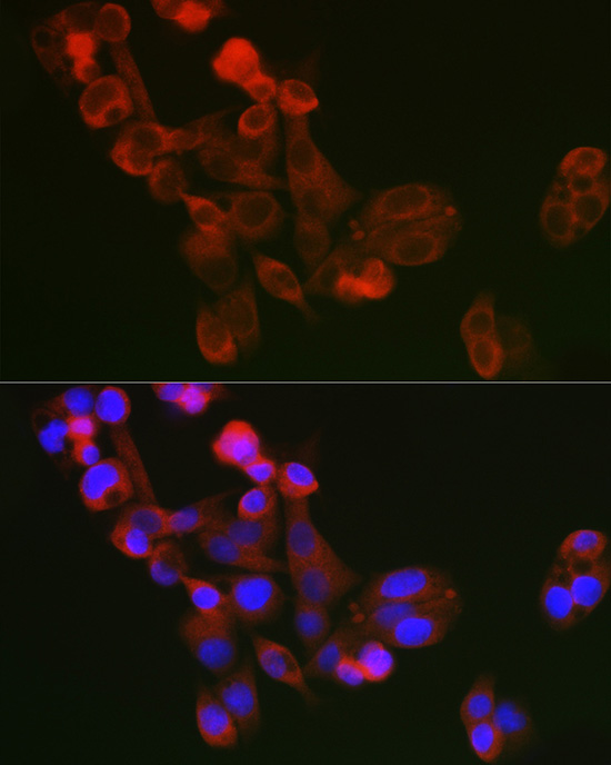 Immunofluorescence analysis of A375 cells using ECM1 Polyclonal Antibody at dilution of 1:100 (40x lens). Blue: DAPI for nuclear staining.