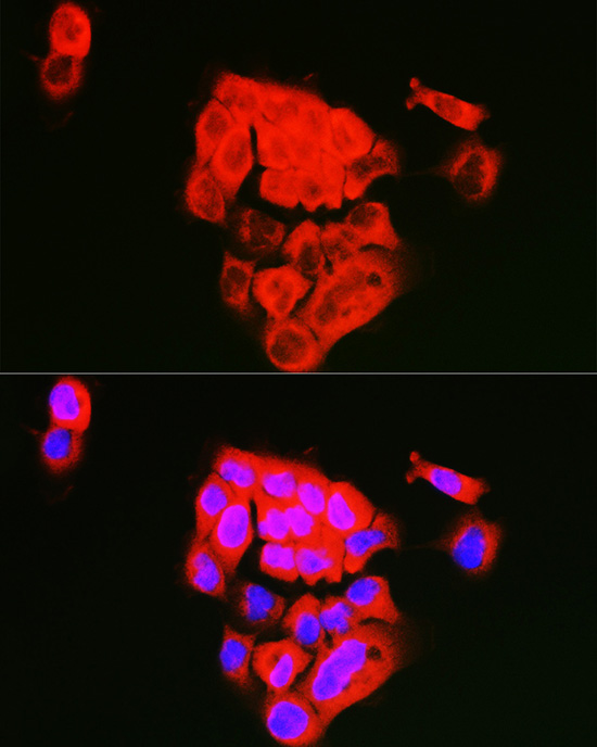 Immunofluorescence analysis of A431 cells using ECM1 Polyclonal Antibody at dilution of 1:100 (40x lens). Blue: DAPI for nuclear staining.