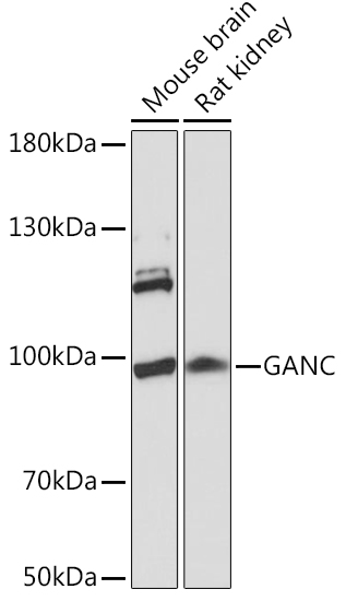 Western blot analysis of extracts of various cell lines using GANC Polyclonal Antibody at1:1000 dilution.