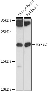 Western blot analysis of extracts of various cell lines using HSPB2 Polyclonal Antibody at 1:1000 dilution.