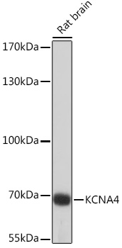 Western blot analysis of extracts of Rat brain using KCNA4 Polyclonal Antibody at 1:1000 dilution.