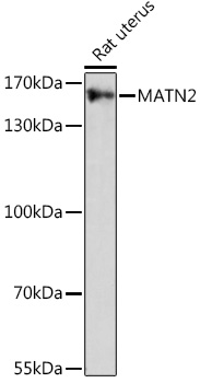 Western blot analysis of extracts of Rat uterus using MATN2 Polyclonal Antibody at 1:1000 dilution.