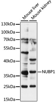 Western blot analysis of extracts of various cell lines using NUBP1 Polyclonal Antibody at 1:1000 dilution.