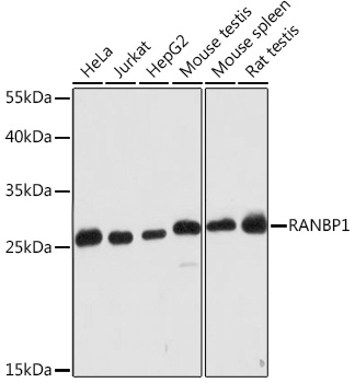 Western blot analysis of extracts of various cell lines using RANBP1 Polyclonal Antibody at1:2000 dilution.