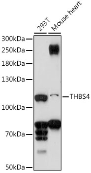 Western blot analysis of extracts of various cell lines using THBS4 Polyclonal Antibody at 1:1000 dilution.