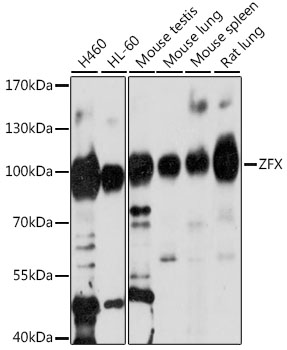 Western blot analysis of extracts of various cell lines using ZFX Polyclonal Antibody at 1:1000 dilution.