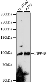 Western blot analysis of extracts of various cell lines using INPP4B Polyclonal Antibody at 1:1000 dilution.