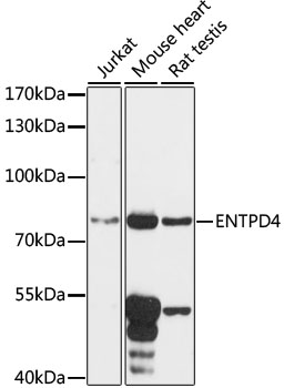 Western blot analysis of extracts of various cell lines using ENTPD4 Polyclonal Antibody at 1:1000 dilution.