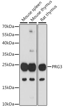 Western blot analysis of extracts of various cell lines using PRG3 Polyclonal Antibody at 1:1000 dilution.