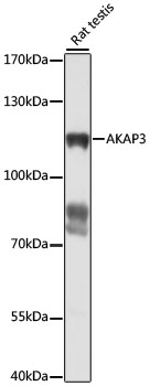 Western blot analysis of extracts of rat testis using AKAP3 Polyclonal Antibody at 1:1000 dilution.