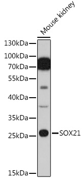 Western blot analysis of extracts of Mouse kidney cells using SOX21 Polyclonal Antibody at 1:1000 dilution.