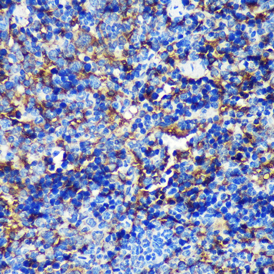 Immunohistochemistry of paraffin-embedded Mouse spleen using CAND2 Polyclonal Antibody at dilution of 1:100 (40x lens).Perform microwave antigen retrieval with 10 mM PBS buffer pH 7.2 before commencing with IHC staining protocol.