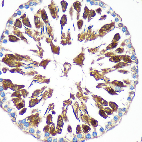 Immunohistochemistry of paraffin-embedded Rat testis using CAND2 Polyclonal Antibody at dilution of 1:100 (40x lens).Perform microwave antigen retrieval with 10 mM PBS buffer pH 7.2 before commencing with IHC staining protocol.