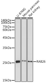 Western blot analysis of extracts of various cell lines using RAB26 Polyclonal Antibody at 1:1000 dilution.