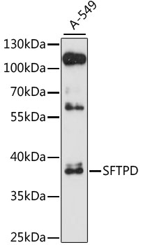 Western blot analysis of extracts of A-549 cells using Surfactant protein D/SP-D Polyclonal Antibody at 1:3000 dilution.