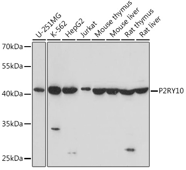 Western blot analysis of extracts of various cell lines using P2RY10 Polyclonal Antibody at1:1000 dilution.