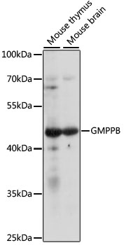 Western blot analysis of extracts of various cell lines using GMPPB Polyclonal Antibody at 1:1000 dilution.