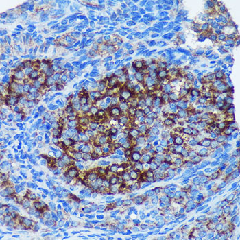 Immunohistochemistry of paraffin-embedded Rat ovary using MRPL30 Polyclonal Antibody at dilution of 1:100 (40x lens).Perform microwave antigen retrieval with 10 mM PBS buffer pH 7.2 before commencing with IHC staining protocol.