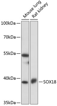 Western blot analysis of extracts of various cell lines using SOX18 Polyclonal Antibody at 1:1000 dilution.