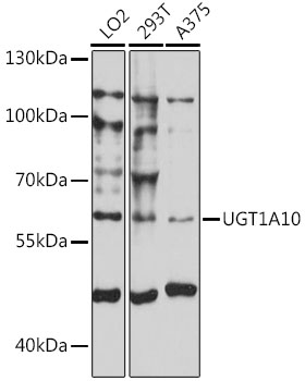 Western blot analysis of extracts of various cell lines using UGT1A10 Polyclonal Antibody at 1:1000 dilution.