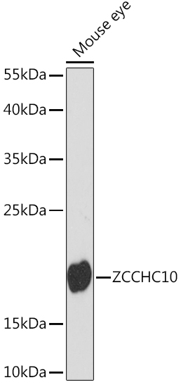 Western blot analysis of extracts of Mouse eye using ZCCHC10 Polyclonal Antibody at1:1000 dilution.