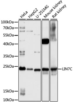 Western blot analysis of extracts of various cell lines using LIN7C Polyclonal Antibody at 1:1000 dilution.