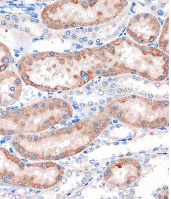 Immunohistochemistry of paraffin-embedded Rat kidney using CHDH Polyclonal Antibody at dilution of 1:100 (40x lens).Perform microwave antigen retrieval with 10 mM PBS buffer pH 7.2 before commencing with IHC staining protocol.