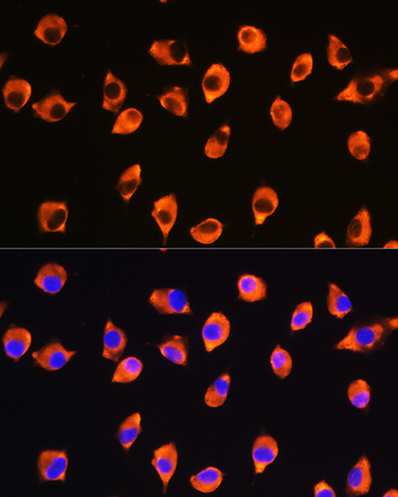 Immunofluorescence analysis of L929 cells using KIF21A Polyclonal Antibody at dilution of 1:100. Blue: DAPI for nuclear staining.