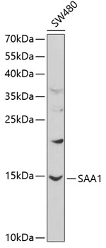 Western blot analysis of extracts of SW480 cells using SAA1 Polyclonal Antibody at 1:1000 dilution.