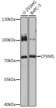 Western blot analysis of extracts of various cell lines using CPXM1 Polyclonal Antibody at 1:1000 dilution.