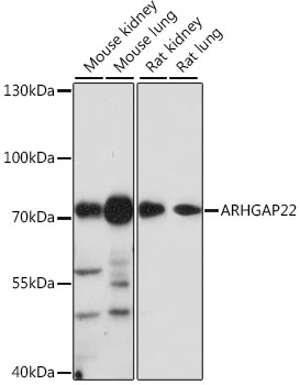 Western blot analysis of extracts of various cell lines using ARHGAP22 Polyclonal Antibody at 1:1000 dilution.