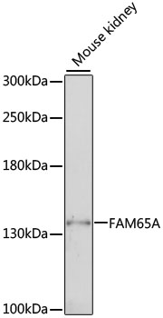 Western blot analysis of extracts of mouse kidney using FAM65A Polyclonal Antibody at 1:1000 dilution.