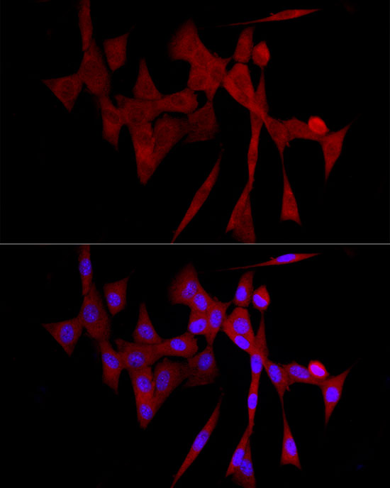 Immunofluorescence analysis of NIH/3T3 cells using COLGALT1 Polyclonal Antibody at dilution of 1:100 (40x lens). Blue: DAPI for nuclear staining.