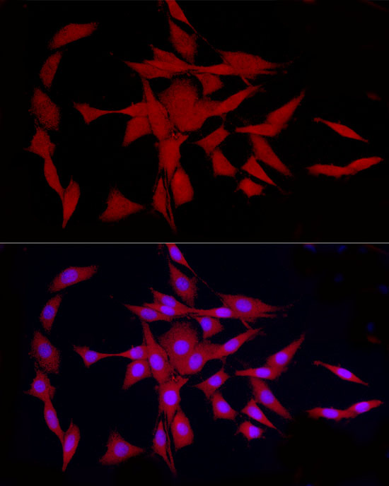 Immunofluorescence analysis of PC-12 cells using COLGALT1 Polyclonal Antibody at dilution of 1:100 (40x lens). Blue: DAPI for nuclear staining.