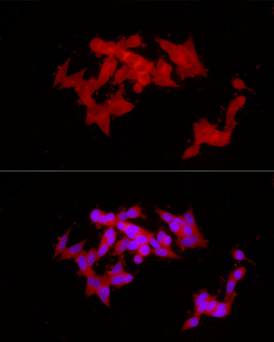 Immunofluorescence analysis of SH-SY5Y cells using COLGALT1 Polyclonal Antibody at dilution of 1:100 (40x lens). Blue: DAPI for nuclear staining.