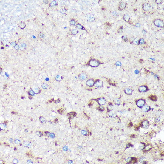 Immunohistochemistry of paraffin-embedded Rat brain using STARD3NL Polyclonal Antibody at dilution of 1:100 (40x lens).Perform microwave antigen retrieval with 10 mM PBS buffer pH 7.2 before commencing with IHC staining protocol.