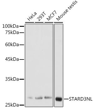 Western blot analysis of extracts of various cell lines using STARD3NL Polyclonal Antibody at 1:1000 dilution.