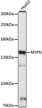 Western blot analysis of extracts of HepG2 cells using MYPN Polyclonal Antibody at 1:1000 dilution.