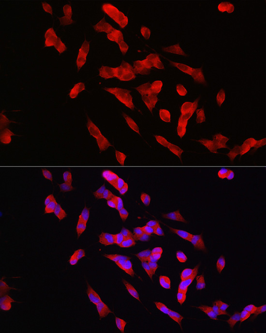 Immunofluorescence analysis of SH-SY5Y cells using PTPN5 Polyclonal Antibody at dilution of 1:100 (40x lens). Blue: DAPI for nuclear staining.