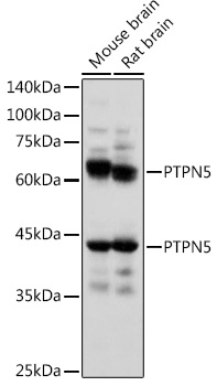 Western blot analysis of extracts of various cell lines using PTPN5 Polyclonal Antibody at 1:1000 dilution.