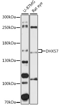 Western blot analysis of extracts of various cell lines using DHX57 Polyclonal Antibody at 1:1000 dilution.