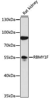 Western blot analysis of extracts of rat kidney using RBMY1F Polyclonal Antibody at 1:1000 dilution.