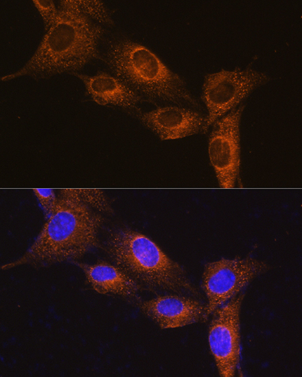 Immunofluorescence analysis of NIH/3T3 cells using NPB Polyclonal Antibody at dilution of 1:100. Blue: DAPI for nuclear staining.