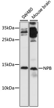 Western blot analysis of extracts of various cell lines using NPB Polyclonal Antibody at 1:1000 dilution.